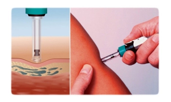 注射器密合性正压负压测试仪对器身密封性质量检测的重要性